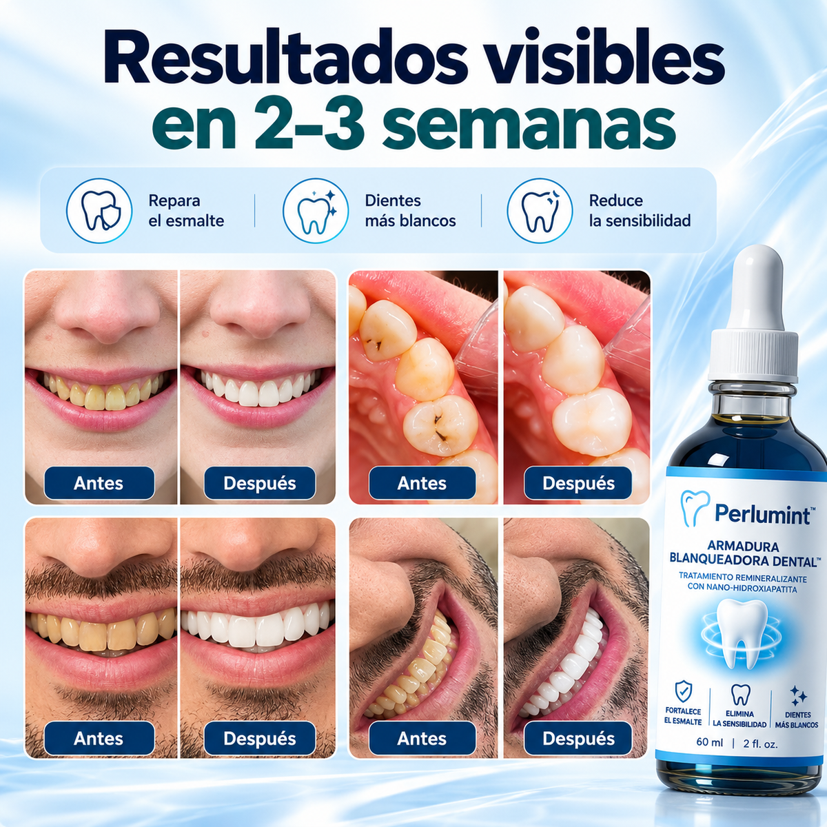Perlumint – Armadura de Esmalte™