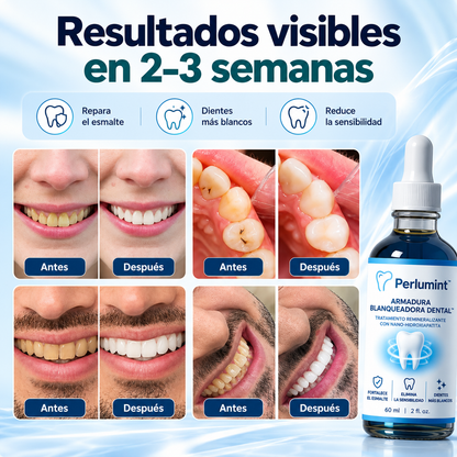 Perlumint – Armadura de Esmalte™